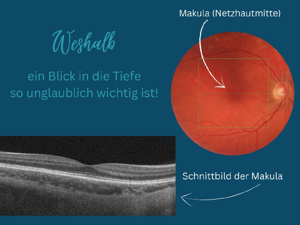 Augenärzte im Zentrum Heilbronn - Makula