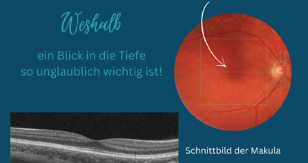 Augenärzte im Zentrum Heilbronn - Makula